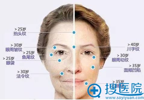 女人面部皱纹产生阶段时间表