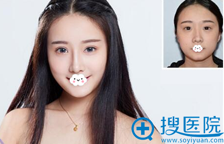 深圳整形排名_深圳免费景点好玩排名