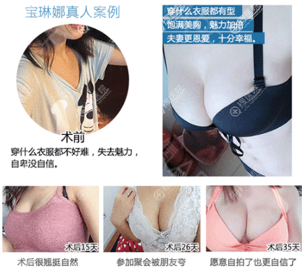 丰胸医院排名_丰胸整形医院排名(2)