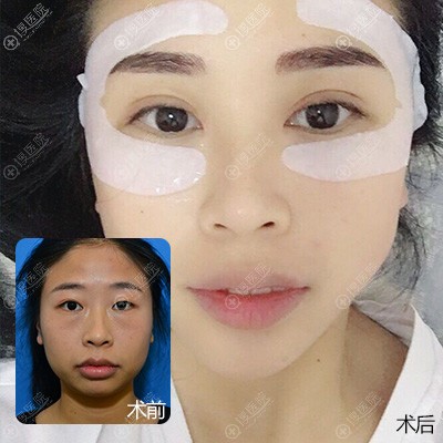 整形整容医院排名_上海整形整容医院(3)