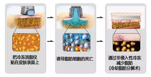 ǿ䶳֬ԭ