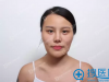 韩国女神轮廓手术真人案例 吊炸天的换头记录