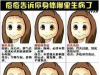 温州118整形果酸换肤 祛痘美白还除皱