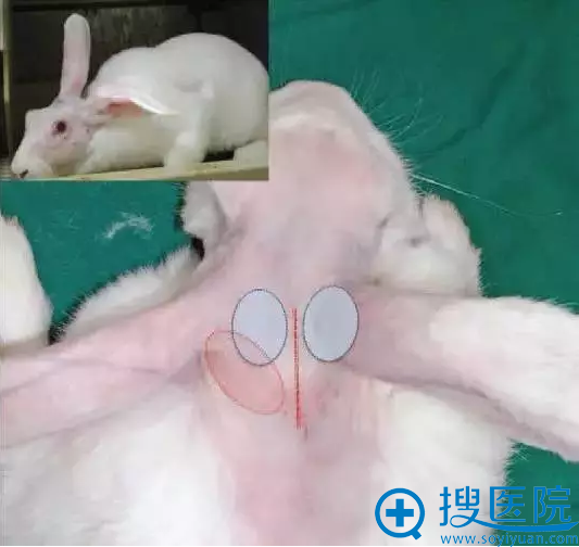 兔子耳朵前部瘦脸除皱和玻尿酸注射位置