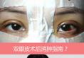 北京八大处整形布仁医生分享双眼皮术后注意事项及消肿指南