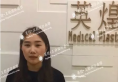 分享我在北京英煌找王勋院长做假体隆鼻+双眼皮手术的真实经历