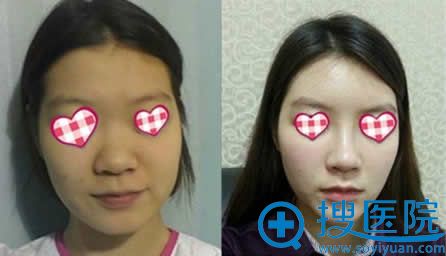 iFace¡ǰԱƬ
