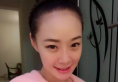 【真实经历】看我在杭州yestar找刘波做鼻综合术后1-7天的照片