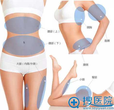Body Tite射频溶脂可改善的部位