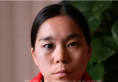 分享在杭州时光整形医院做激光祛除太田痣妹子的亲身经历效果图