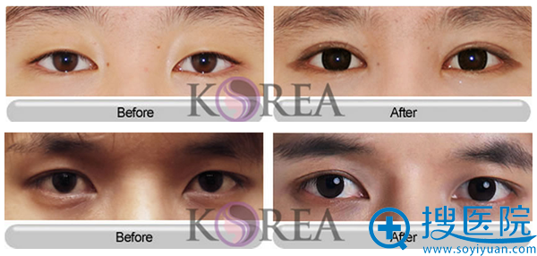 KOREAҽԺ˫Ƥ
