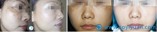南整外美肤祛斑效果 南整外美肤祛斑效果