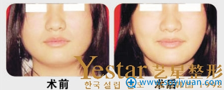 ϺYestar֬Ա