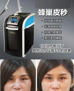 䳲Ƥ뵽׺òãνȫλķ䳲Ƥֱ