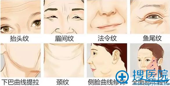 需要线雕部位示意图