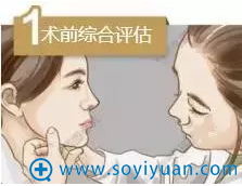 线雕术前综合评估