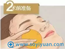 线雕术前准备示意图