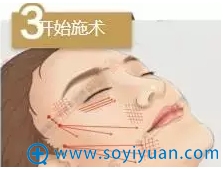 面部线雕过程示意图