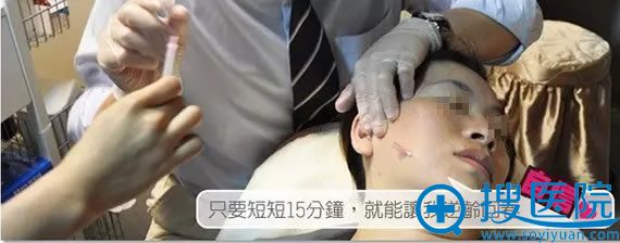 面部线雕提升术手术过程