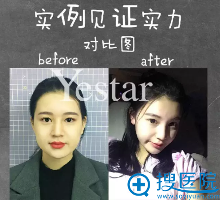 人ǰ