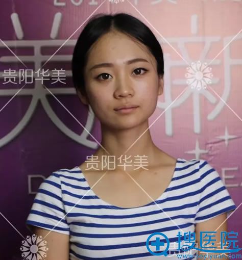 贵阳华美真人秀术前照