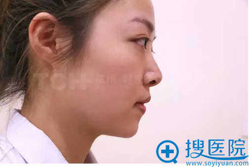 术前侧面照