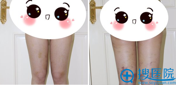 13˫ȵĻָ