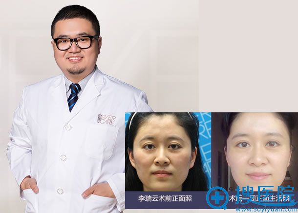王飏_<!--<i data=20240710 data-id=12670></i>-->面部线雕医生