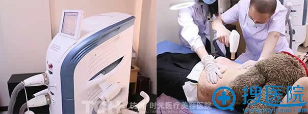 杭州时光激光去除妊娠纹过程