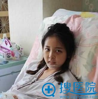 在北京华韩做眼鼻手术第三天