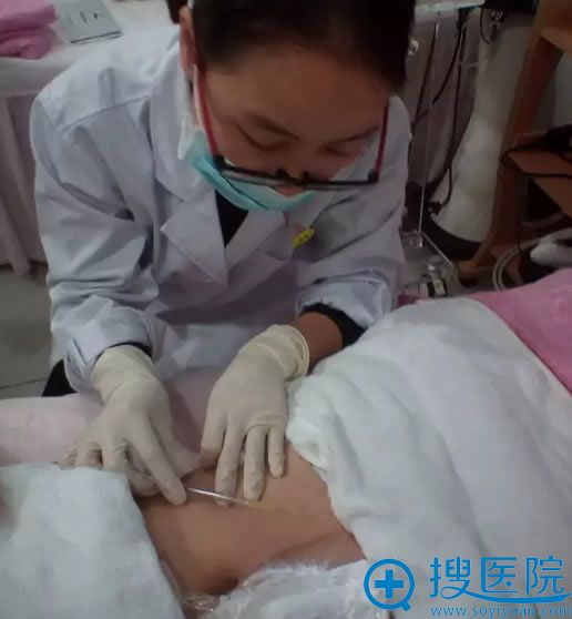 广州华美祛除妊娠纹手术过程