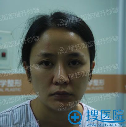 <!--<i data=20240710 data-id=8324></i>-->沿ǰ