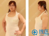 【整形日记】我在南京康美使用360度水动力吸脂减肥的亲身体验 