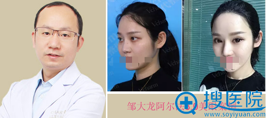 重庆当代邹大龙阿尔法美眼案例