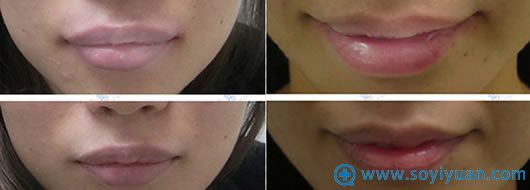 <!--<i data=20240710 data-id=2294></i>-->񴽱䱡ǰԱ