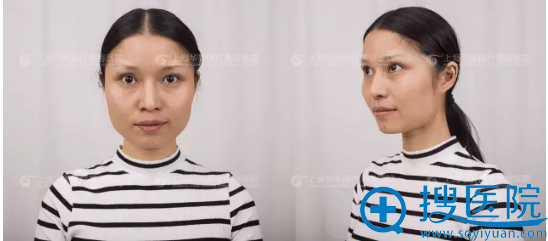ǰ