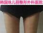 吸脂瘦腿效果怎么样？在韩国珠儿丽做大腿吸脂后瘦了8厘米