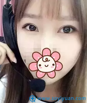 内双妹子割双眼皮术后40天恢复效果