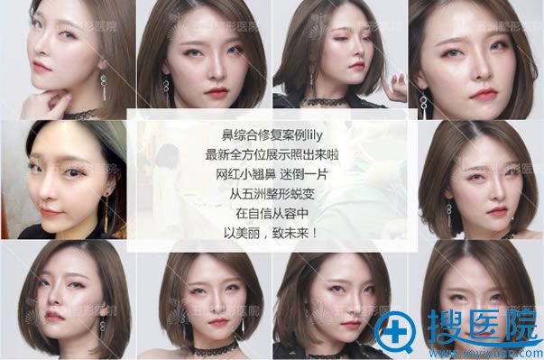 人ޱۺ޸Ч