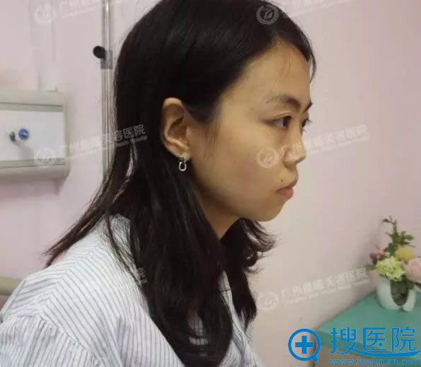 在<!--<i data=20240710 data-id=8320></i>-->整形医院做鼻整形术前照