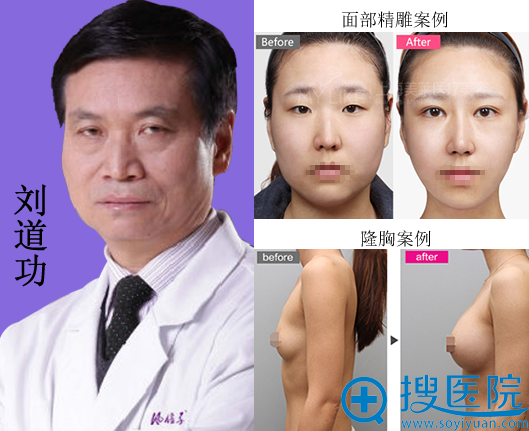 <!--<i data=20240710 data-id=12266></i>-->刘道功隆胸及面部精雕案例