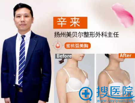 扬州美贝尔整形医生<!--<i data=20240710 data-id=16606></i>-->及医生隆胸案例