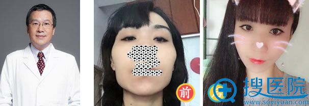 北京八大处磨骨找哪个医生好 推荐5位教授级削骨医生及案例 面部轮廓整形 搜医院