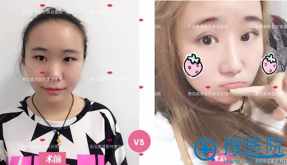 ˫ƤǰԱͼ