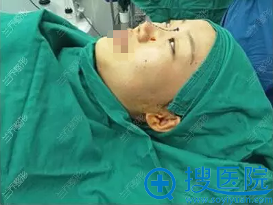 <!--<i data=20240710 data-id=15330></i>-->医疗美容陈邦胤术前设计