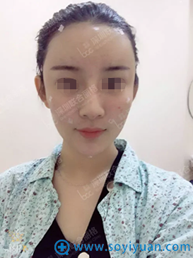 <!--<i data=20240710 data-id=12014></i>-->ݼ֬沿󼴿