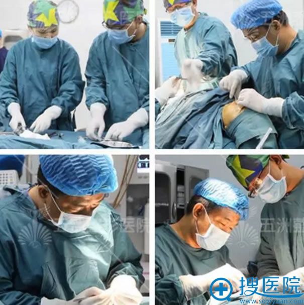 五洲刘骏院长鼻综合手术过程