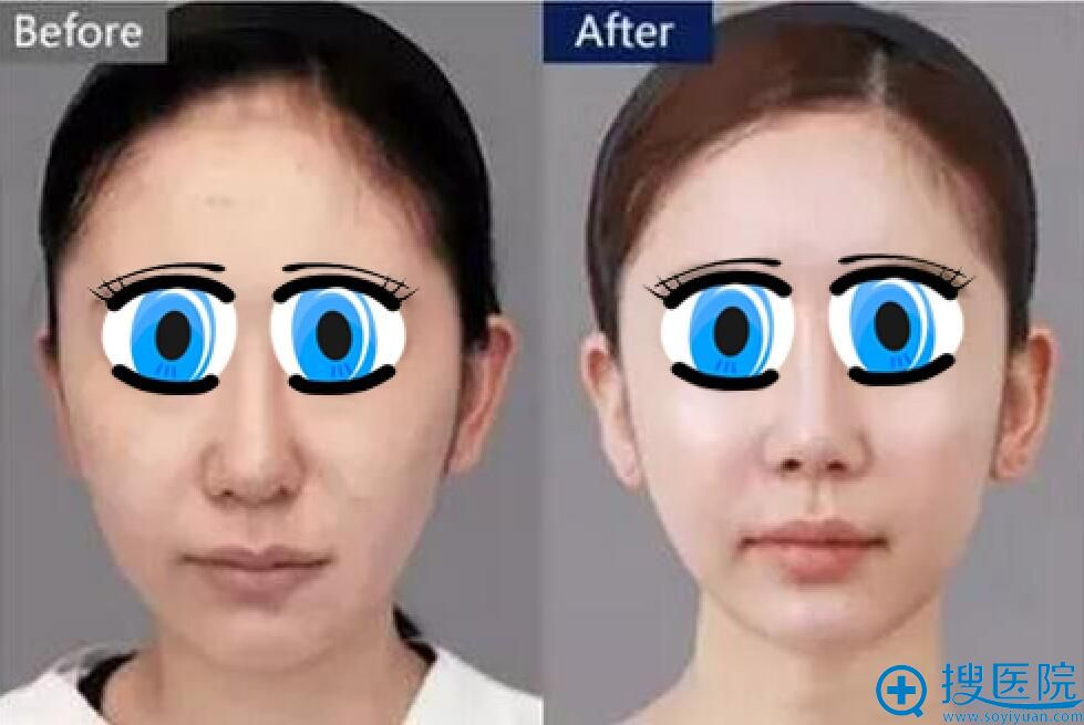 ǰԱ