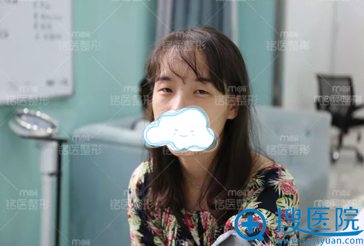 手术前的橙子是小眼睛、眯眯眼