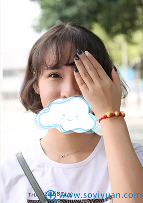 橙子双眼皮手术后生活照